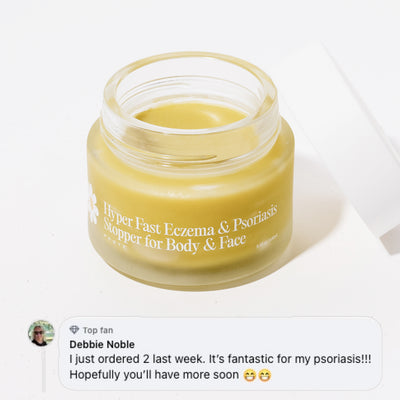 Frøya Organics Ultra-Fast Relief Balm in glass jar with lid – relief balm for dry, itchy skin front view